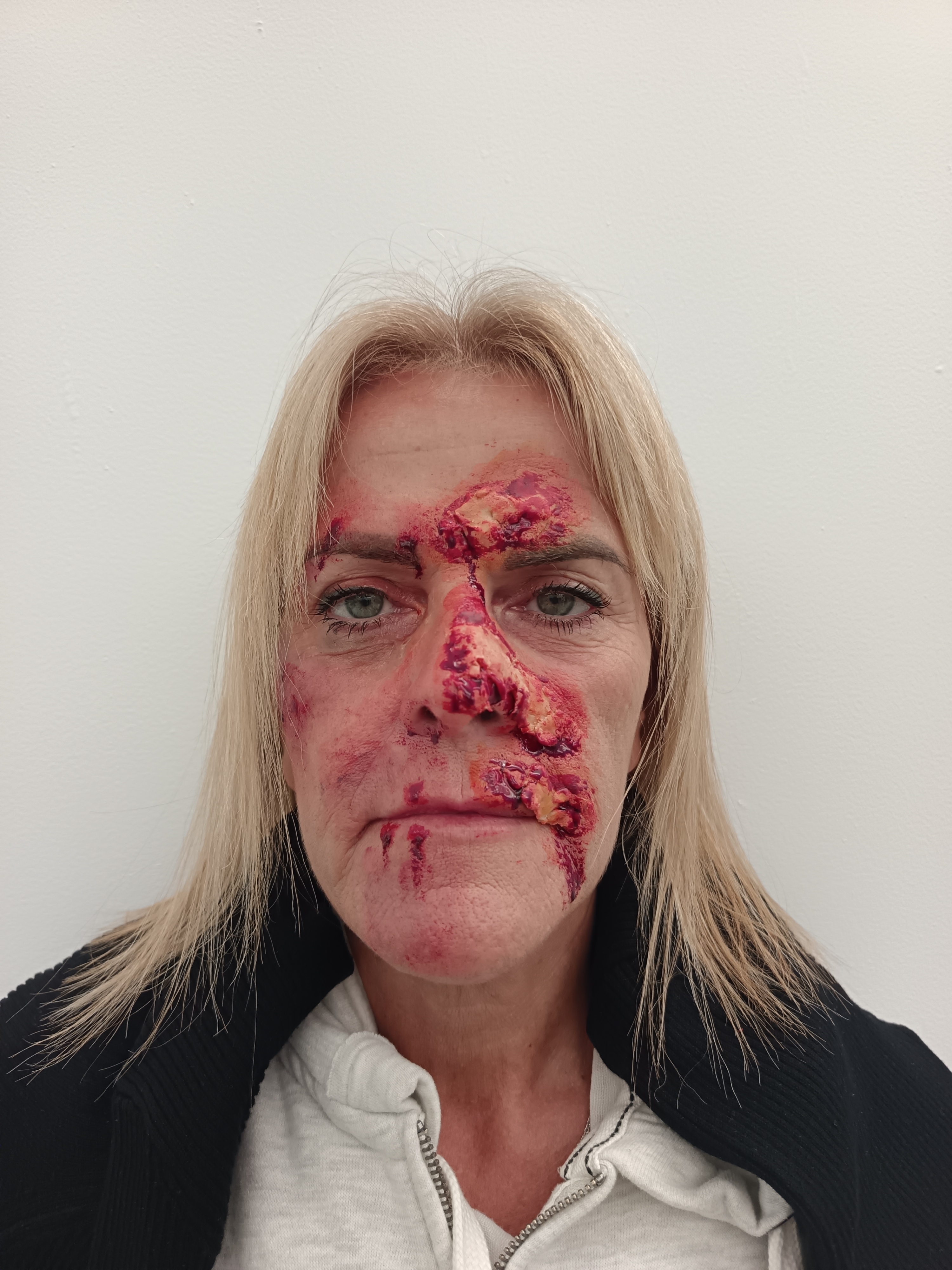 SFX Project - Effetto Livido e Ustione